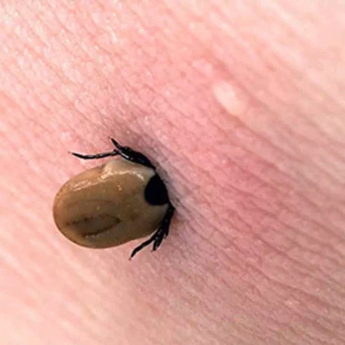 سم کنه کبوتری بلک فلگ ارسال رایگان مدل 1