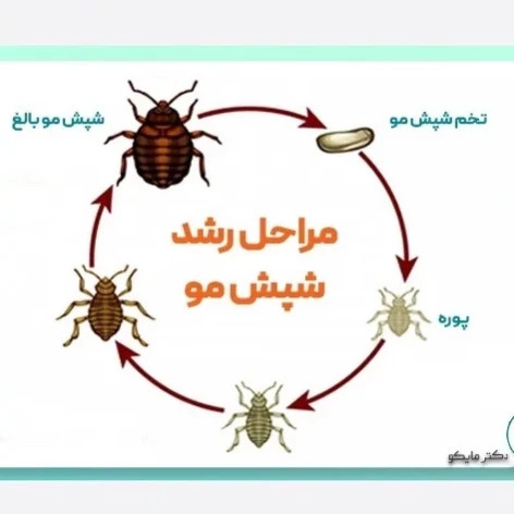 سم شپش کش مو و محیط پرمکترین مبارز قوی شپش ارسال رایگان