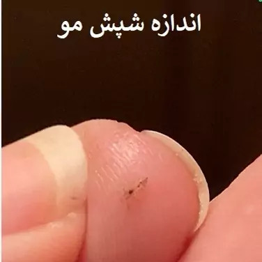 سم شپش کش پرمکترین ارسال رایگان مدل 1