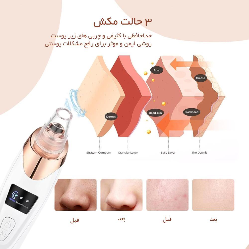 میکرودرم لوتوکس مدل LT-360