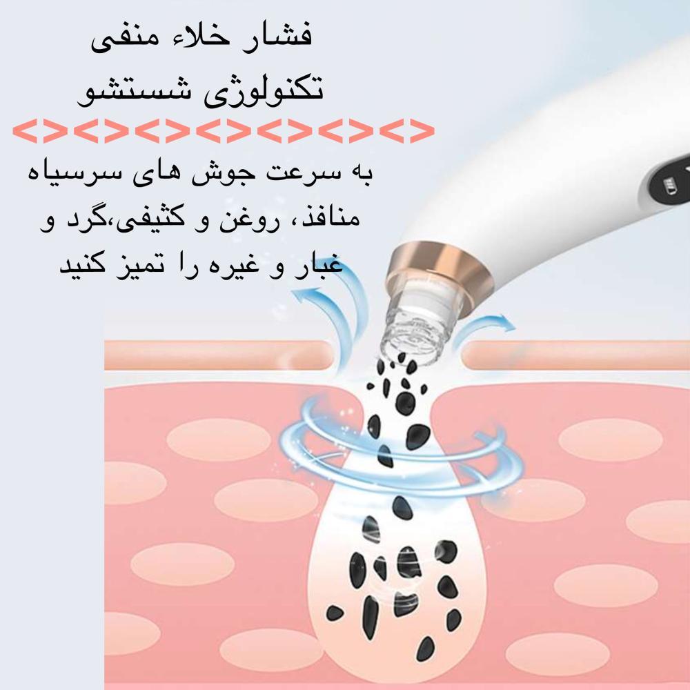 میکرودرم مدل X13