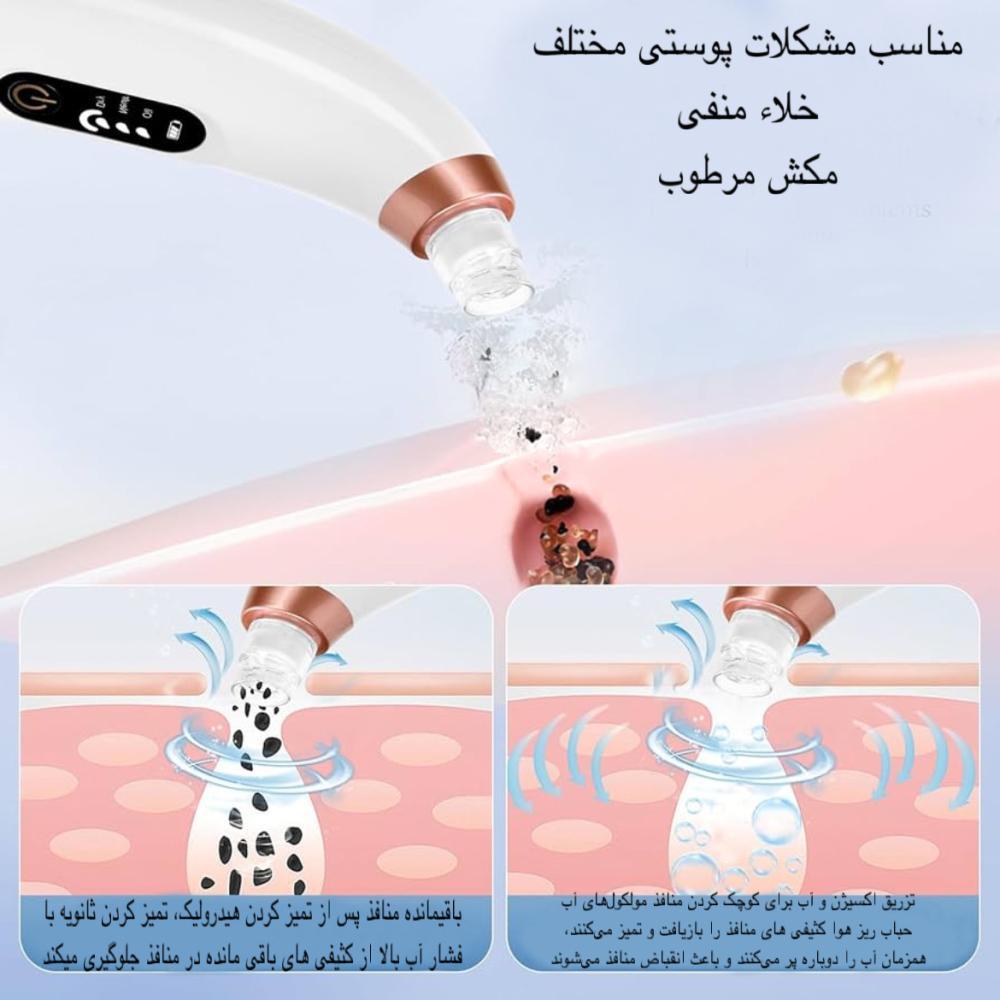 میکرودرم مدل X13