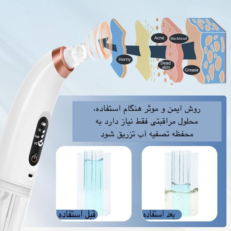 میکرودرم مدل X13