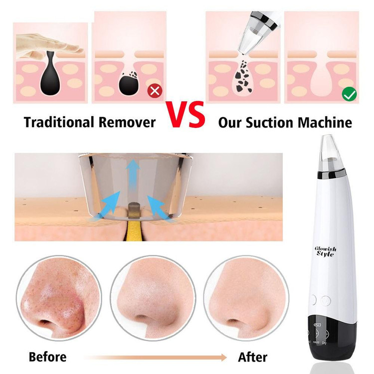 میکرودرم خانگی گلویش استایل مدل MP503