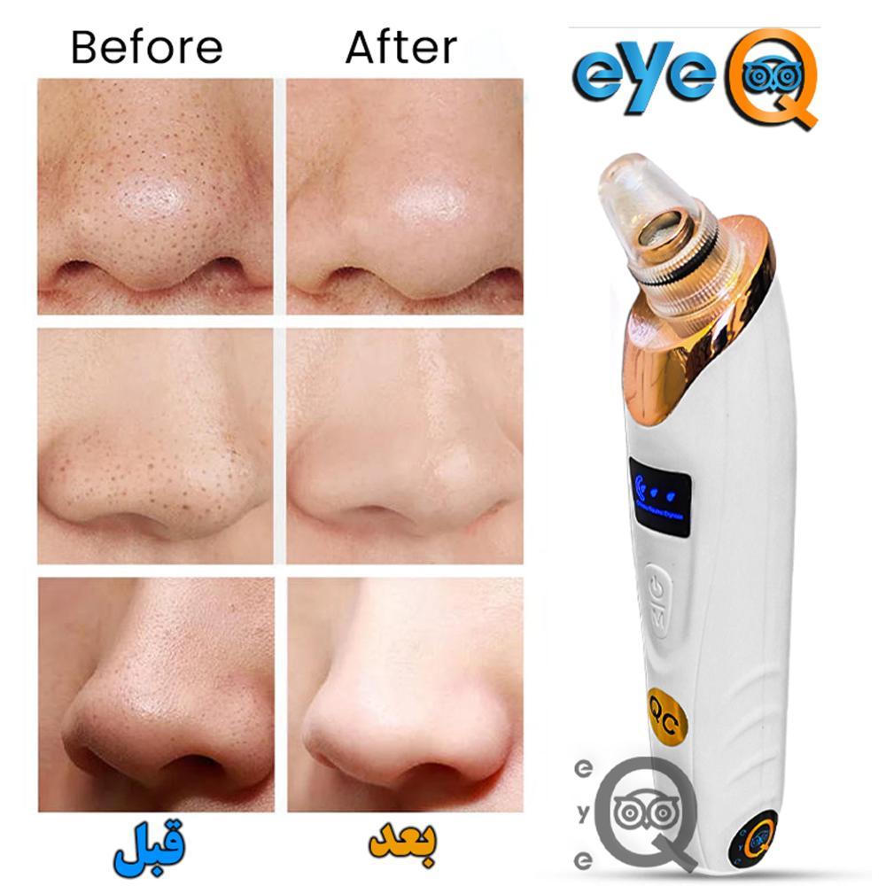 میکرودرم آی کیو مدل New-Face کد UsLine