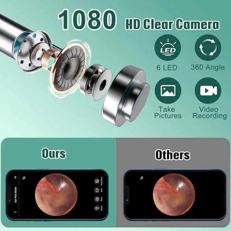 گوش پاک کن برقی مدل LMECHN
